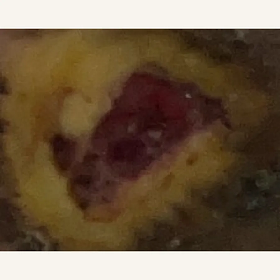 Clinical photograph of a diabetic plantar wound at visit 4, HKL-60