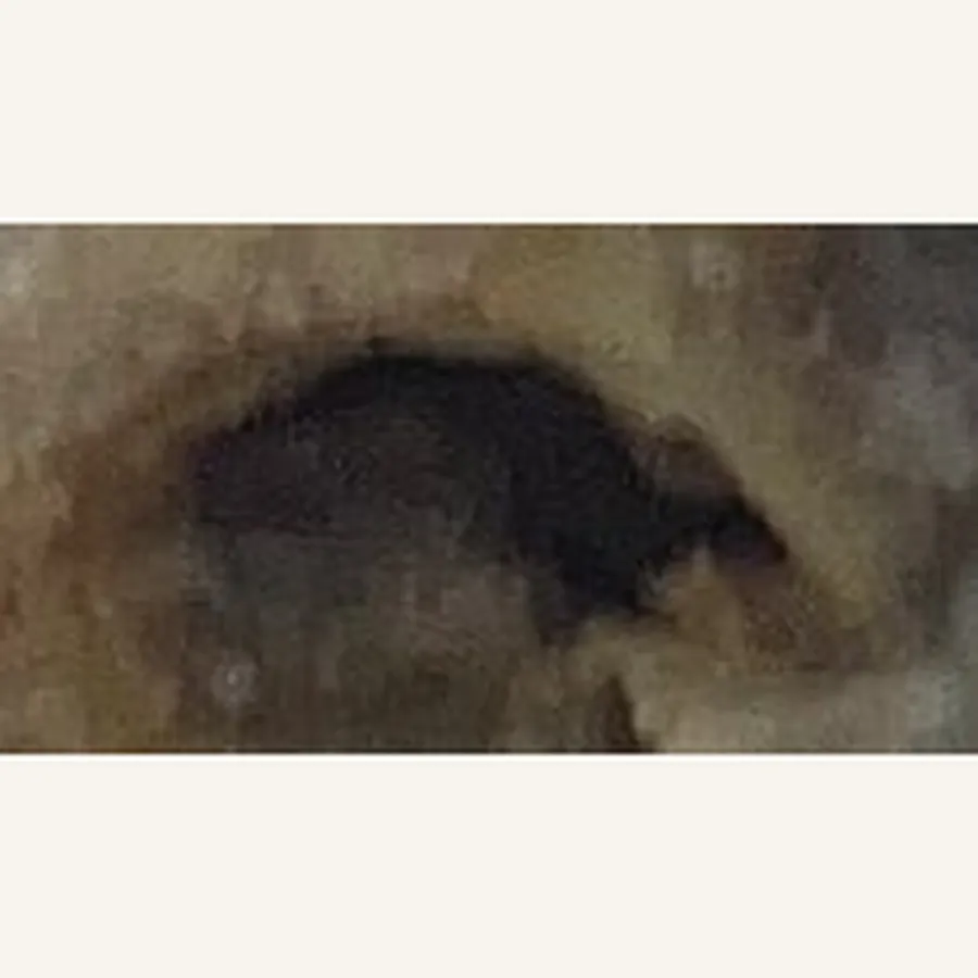 Clinical photograph of a diabetic heel wound at visit 5, HKL-62